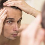 انواع ریزش مو و دلایل آن