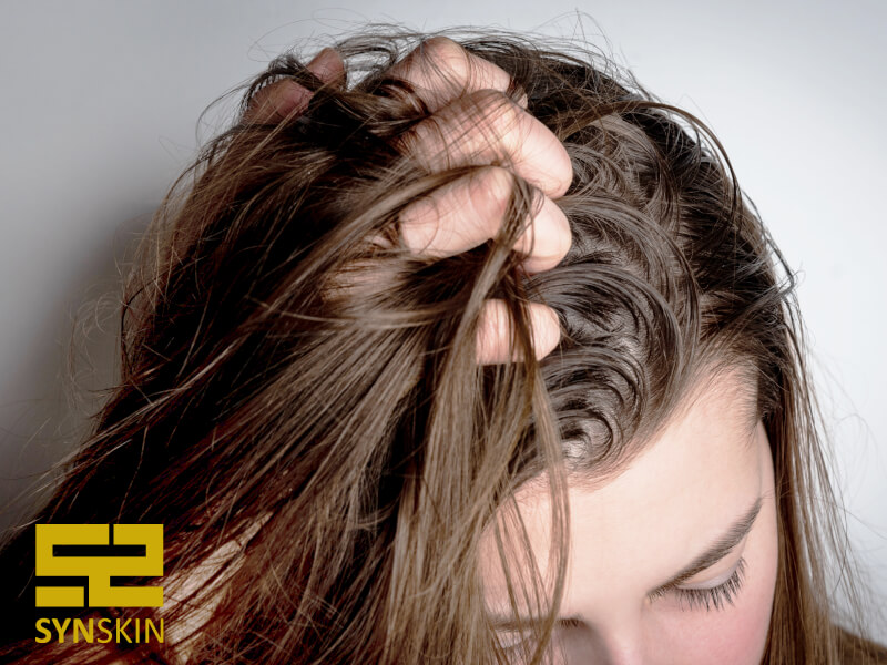 علت چربی موی سر چیست 
