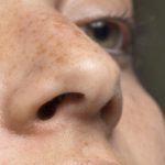 نکات کلیدی برای روشن کردن پوست صورت